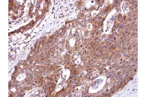Immunohistochemistry (IHC) image for anti-Endothelin Receptor Type B (EDNRB) (N-Term) antibody (ABIN2854727)