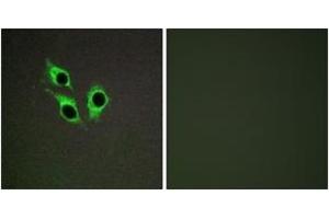 Immunofluorescence analysis of HepG2 cells, using TM16J Antibody.