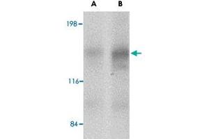Western blot analysis of CADPS2 in human brain tissue lysate with CADPS2 polyclonal antibody  at (A) 0. (CADPS2 Antikörper  (Internal Region))