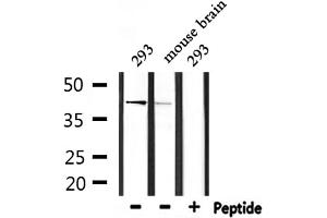 Western blot analysis of extracts from 293 and mouse brain, using ARRDC3 Antibody. (ARRDC3 Antikörper  (C-Term))
