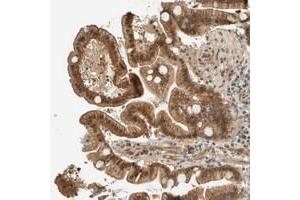 Immunohistochemical staining of human duodenum with FAM129B polyclonal antibody  shows moderate cytoplasmic, nuclear and membranous positivity in glandular cells. (MEG3 Antikörper)