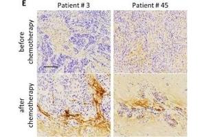 Immunohistochemistry (IHC) image for anti-Periostin (POSTN) (C-Term) antibody (ABIN2854805)