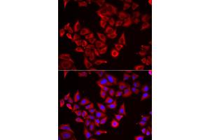 Immunofluorescence analysis of HeLa cells using SRGN antibody (ABIN5974179). (SRGN Antikörper)