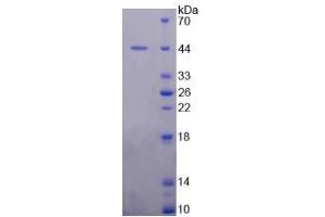 Image no. 1 for Mdm2, p53 E3 Ubiquitin Protein Ligase Homolog (Mouse) (MDM2) (AA 1-321) protein (His tag) (ABIN6237510) (MDM2 Protein (AA 1-321) (His tag))