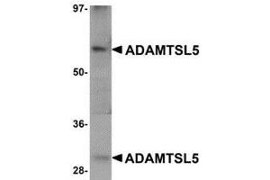 Western blot analysis of ADAMTSL5 in human skeletal muscle tissue lysate with AP30018PU-N ADAMTSL5 antibody at 1 μg/ml. (ADAMTS-Like 5 Antikörper  (C-Term))