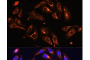 Immunofluorescence analysis of U-2 OS cells using MLPH Polyclonal Antibody at dilution of 1:100. (Melanophilin Antikörper)