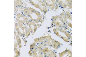 Immunohistochemistry of paraffin-embedded human stomach using ABCF2 antibody at dilution of 1:100 (x40 lens). (ABCF2 Antikörper)