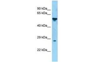 Image no. 1 for anti-Tumor Necrosis Factor (Ligand) Superfamily, Member 8 (TNFSF8) (AA 55-104) antibody (ABIN6748468)