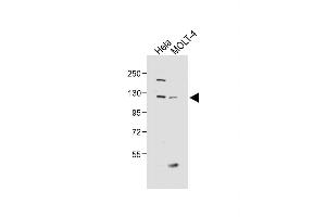 All lanes : Anti-SED Antibody (N-term) at 1:1000 dilution Lane 1: Hela whole cell lysate Lane 2: MOLT-4 whole cell lysate Lysates/proteins at 20 μg per lane. (SEMA6D Antikörper  (N-Term))