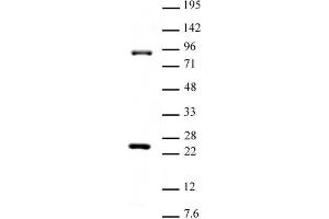 Suz12 antibody (pAb) tested by Western blot.