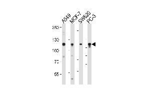 Western blot analysis of lysates from A549, MCF-7, SW620, PC-3 cell line (from left to right), using GAA Antibody at 1:1000 at each lane. (GAA Antikörper  (N-Term))