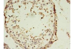 Immunohistochemistry of paraffin-embedded human testis tissue using ABIN7170098 at dilution of 1:100 (SLC13A4 Antikörper  (AA 134-273))