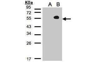 WB Image Western Blot analysis of TAB1 expression in transfected 293T cell line by MAP3K7IP1 polyclonal antibody. (TAB1 Antikörper)