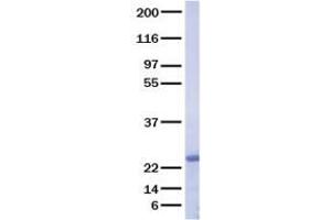 Validation with Western Blot (FGF8 Protein (Transcript Variant F))
