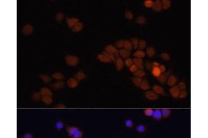 Immunofluorescence analysis of HT-29 cells using APC Polyclonal Antibody at dilution of 1:100. (APC Antikörper)