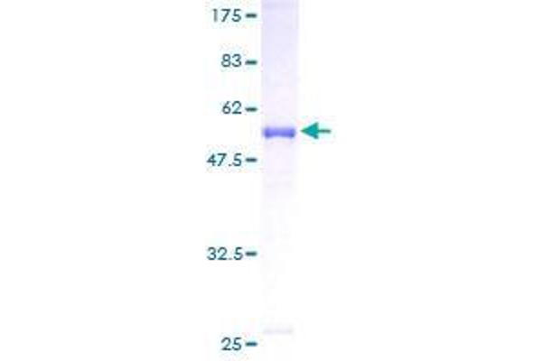 CACYBP Protein (AA 1-228) (GST tag)