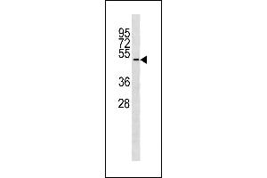 TUBD1 Antibody (C-term) (ABIN1881958 and ABIN2843289) western blot analysis in ZR-75-1 cell line lysates (35 μg/lane). (TUBD1 Antikörper  (C-Term))