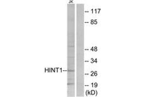Western Blotting (WB) image for anti-Histidine Triad Nucleotide Binding Protein 1 (HINT1) (AA 71-120) antibody (ABIN2889495) (HINT1 Antikörper  (AA 71-120))