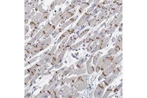 Immunohistochemical staining of human heart muscle with TMEM102 polyclonal antibody  shows distinct positivity of intercalated discs in myocytes.