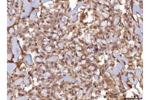 IHC analysis of AHA1/AHSA1 using anti-AHA1/AHSA1 antibody (ABIN7600708).