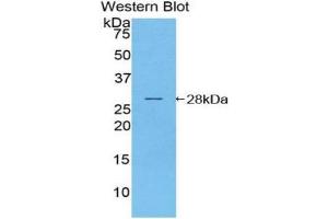 Western blot analysis of the recombinant protein. (NOD1 Antikörper  (AA 612-826))