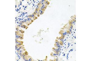 Immunohistochemistry of paraffin-embedded mouse lung using ALKBH8 antibody at dilution of 1:100 (x40 lens). (ALKBH8 Antikörper)
