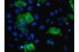 Anti-TBC1D4 mouse monoclonal antibody (ABIN2454437) immunofluorescent staining of COS7 cells transiently transfected by pCMV6-ENTRY TBC1D4 (RC212105). (TBC1D4 Antikörper)