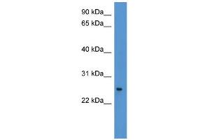WB Suggested Anti-PYCARD Antibody Titration: 0. (PYCARD Antikörper  (C-Term))