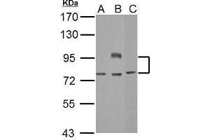 WB Image Sample (30 ug of whole cell lysate) A: Jurkat B: Raji C: NCI-H929 7. (BCL6 Antikörper  (Internal Region))