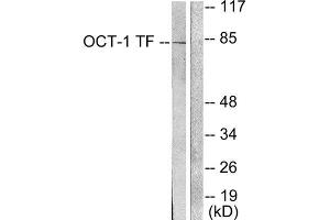 Western Blotting (WB) image for anti-POU Domain, Class 2, Transcription Factor 1 (POU2F1) (N-Term) antibody (ABIN1848704)
