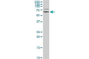 Western Blotting (WB) image for anti-G Protein-Coupled Receptor Kinase 6 (GRK6) (AA 71-170) antibody (ABIN561112)