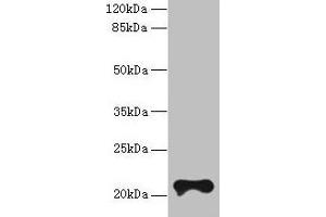 Western blot All lanes: TMEM154 antibody at 6 μg/mL + MCF-7 whole cell lysate Secondary Goat polyclonal to rabbit IgG at 1/10000 dilution Predicted band size: 21 kDa Observed band size: 21 kDa (TMEM154 Antikörper  (AA 97-183))