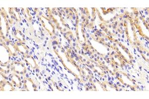 Detection of MMP1 in Rat Kidney Tissue using Polyclonal Antibody to Matrix Metalloproteinase 1 (MMP1)