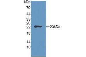 Detection of Recombinant LCAT, Human using Polyclonal Antibody to Lecithin Cholesterol Acyltransferase (LCAT) (LCAT Antikörper  (AA 41-210))