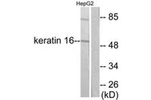 Western blot analysis of extracts from HepG2 cells, using Keratin 16 Antibody. (KRT16 Antikörper  (AA 421-470))