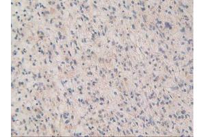 Figure. (MAPKAP Kinase 2 Antikörper  (AA 139-367))