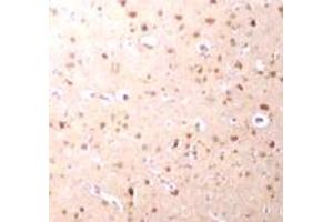 Immunohistochemical staining of human brain tissue with 2. (NANOS3 Antikörper  (C-Term))