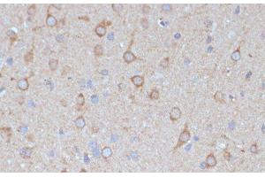 Immunohistochemistry of paraffin-embedded Rat brain using COPG2 Polyclonal Antibody at dilution of 1:100 (40x lens). (COPG2 Antikörper)