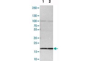 Western blot analysis of cell lysates with SSR3 polyclonal antibody . (SSR3 Antikörper)