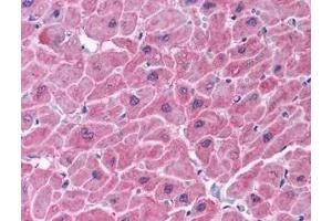 Immunohistochemistry of ARC in human heart tissue (A) and skeletal muscle (B) with ARC antibody at 5 μg/ml. (NOL3 Antikörper  (C-Term))