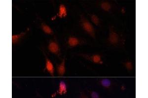 Immunofluorescence analysis of C6 cells using GBX2 Polyclonal Antibody at dilution of 1:100. (GBX2 Antikörper)