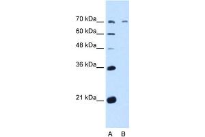WB Suggested Anti-GALNT6 Antibody Titration:  5. (GALNT6 Antikörper  (N-Term))