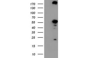 Western Blotting (WB) image for anti-CNDP Dipeptidase 2 (Metallopeptidase M20 Family) (CNDP2) antibody (ABIN1497548)