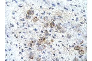 Rabbit Anti-PSMD14 Antibody       Paraffin Embedded Tissue:  Human neural cell   Cellular Data:  Epithelial cells of renal tubule  Antibody Concentration:   4. (PSMD14 Antikörper  (C-Term))