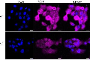 Immunocytochemical staining of HT- cells using RELB antibody (ABIN7800804), 1:1,000), Top panel: wild-type (WT), Bottom panal: RELB shRNA knockdown (KD). (Rekombinanter RELB Antikörper)