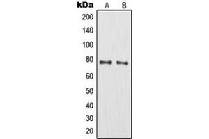 Western blot analysis of MMP9 expression in HT1080 (A), HuvEc (B) whole cell lysates. (MMP 9 Antikörper  (C-Term))