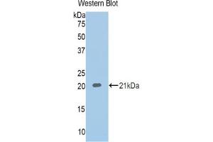Western blot analysis of recombinant Human CBG. (SERPINA6 Antikörper  (AA 218-378))