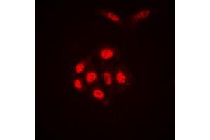 Immunofluorescent analysis of Histone H4 (AcK16) staining in HEK293T cells. (Histone H4 Antikörper  (acLys16, N-Term))