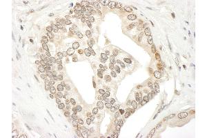 Immunohistochemistry (IHC) image for anti-Janus Kinase 2 (JAK2) (AA 1082-1132) antibody (ABIN7454809)
