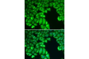 Immunofluorescence analysis of U2OS cells using CASP10 antibody (ABIN5970048). (Caspase 10 Antikörper)